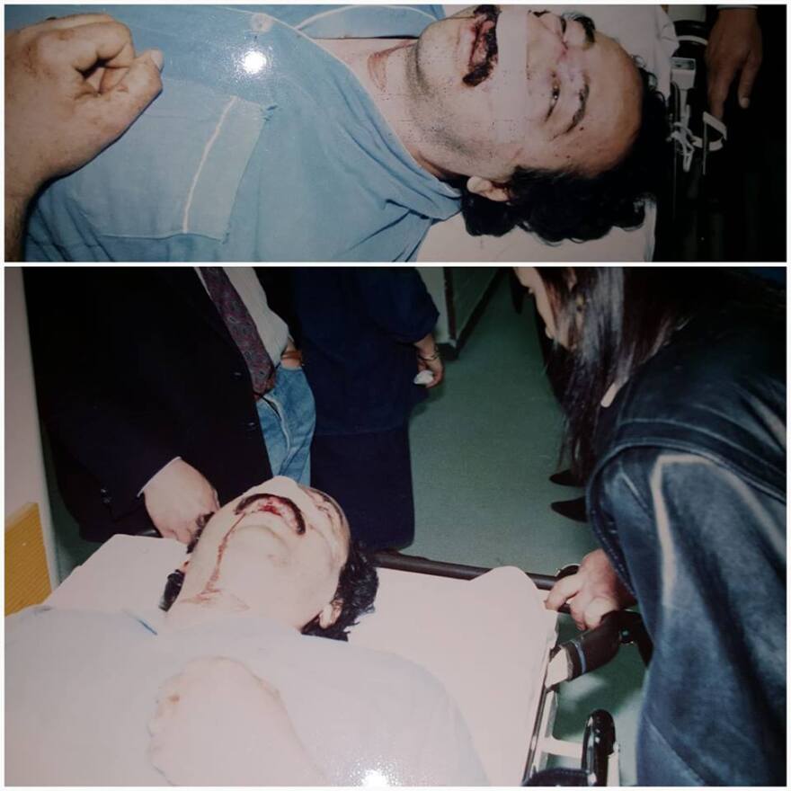 Οι συγκλονιστικές φωτογραφίες του Άγγελου Πυριόχου, 29 χρόνια μετά το αεροπορικό του ατύχημα 