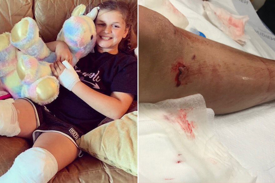 Φλόριντα: 10χρονο κορίτσι πάλεψε με καρχαρία και νίκησε