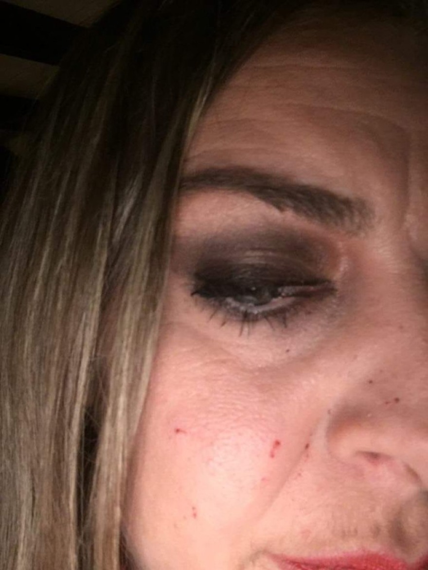 Η σχεδιάστρια μόδας Αθηνά Τρανούλη δέχτηκε επίθεση με λοστούς