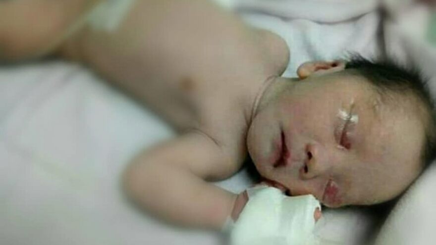 Ταϊλάνδη: Ανάπηρος σκύλος - ήρωας έσωσε νεογέννητο που το είχαν θάψει ζωντανό 