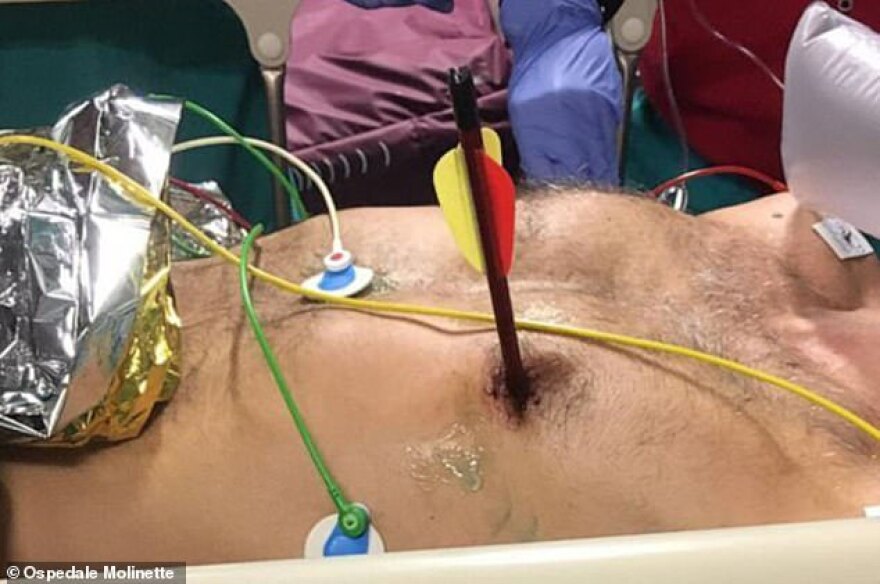 Φωτογραφία: Του καρφώθηκε βέλος στην καρδιά και σώθηκε!