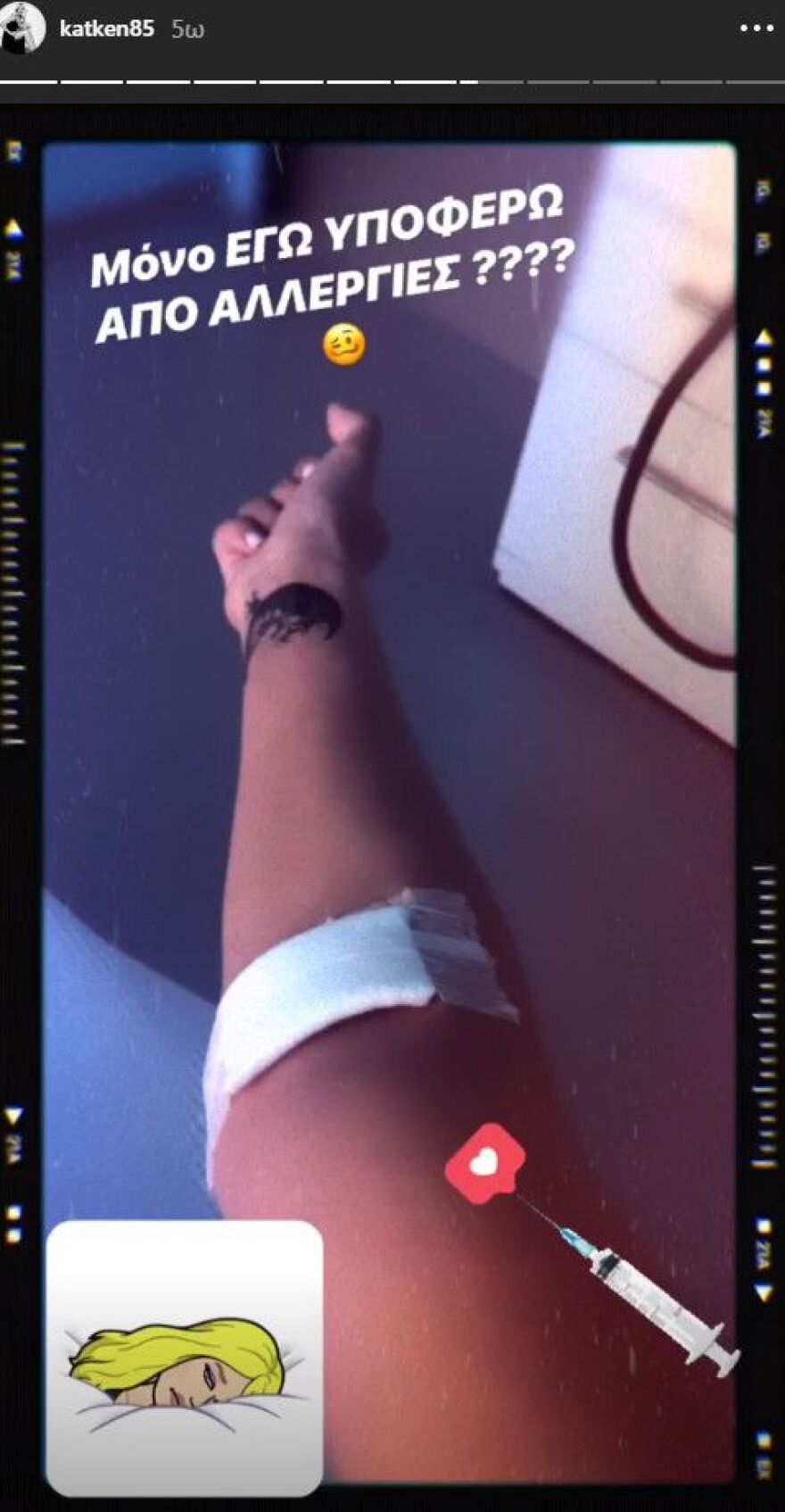 Κατερίνα Καινούργιου: Μόνο εγώ υποφέρω από αλλεργίες;