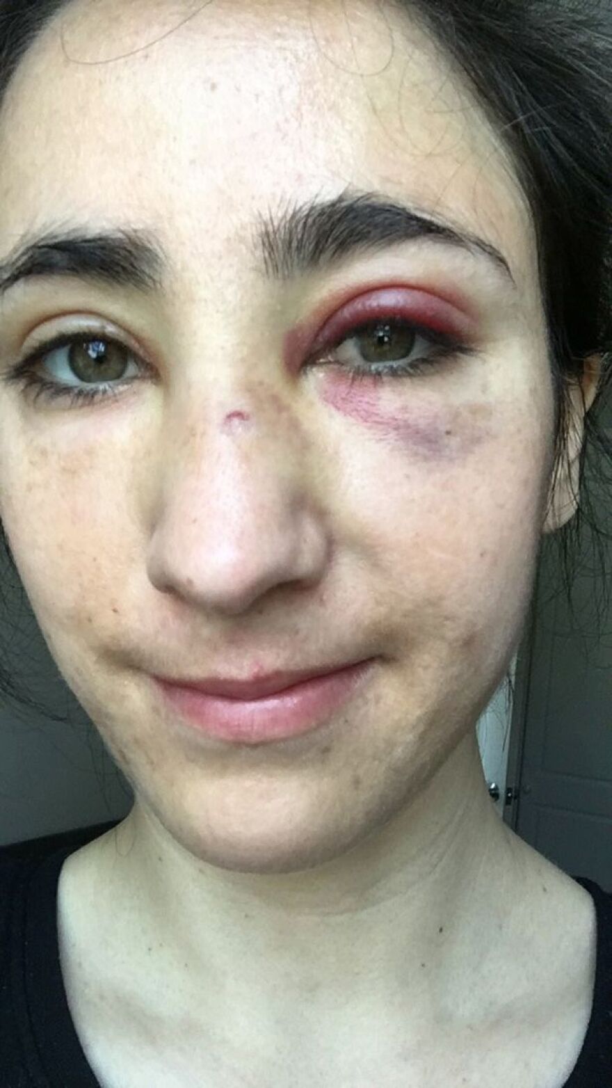 Γρονθοκόπησαν αεροσυνοδό και την κοπέλα της γιατί αρνήθηκαν να φιληθούν