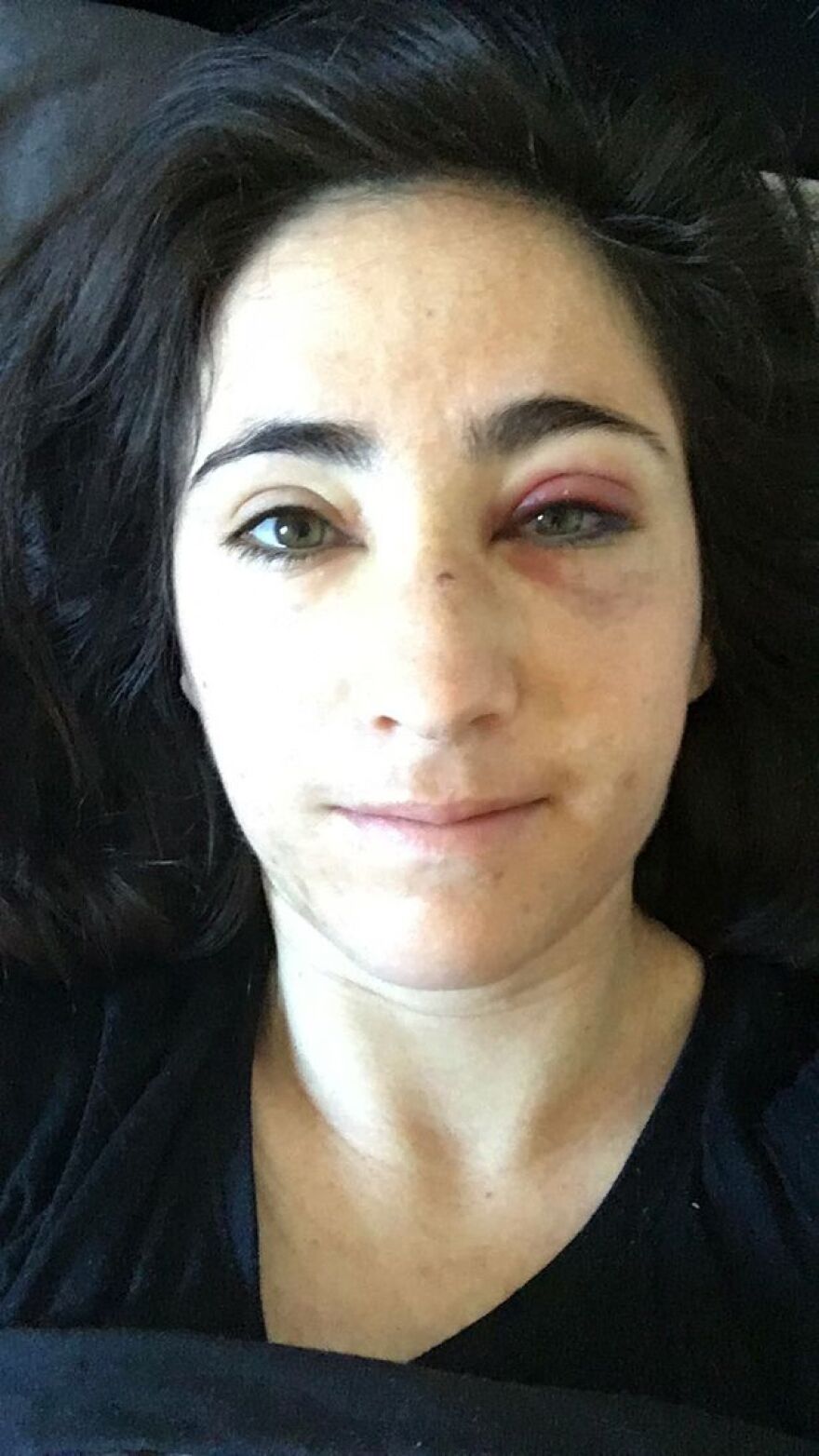 Γρονθοκόπησαν αεροσυνοδό και την κοπέλα της γιατί αρνήθηκαν να φιληθούν