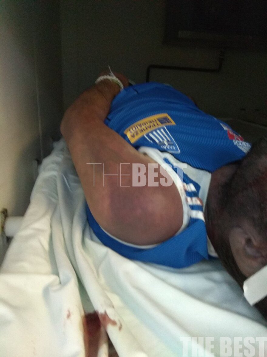 Νεκρός από ξύλο ο κρατούμενος στις φυλακές της Πάτρας