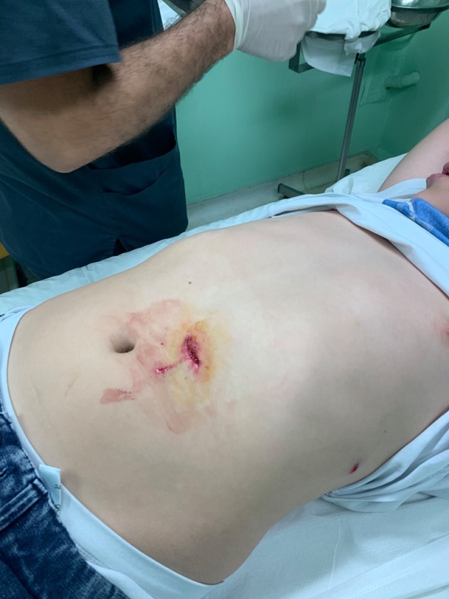 Βριλήσσια: 11χρονος καρφώθηκε στα κάγκελα εκκλησίας 