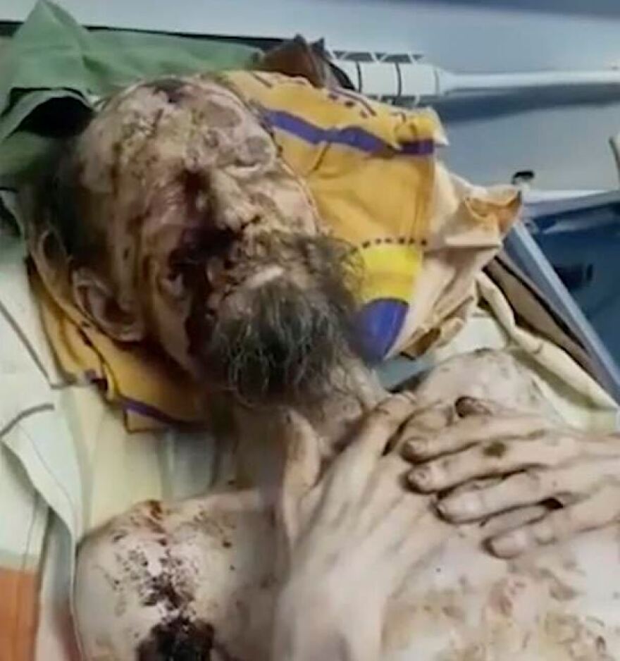 Τι ισχύει πραγματικά για τον άνδρα «που βρέθηκε ετοιμοθάνατος στη φωλιά μιας αρκούδας»;