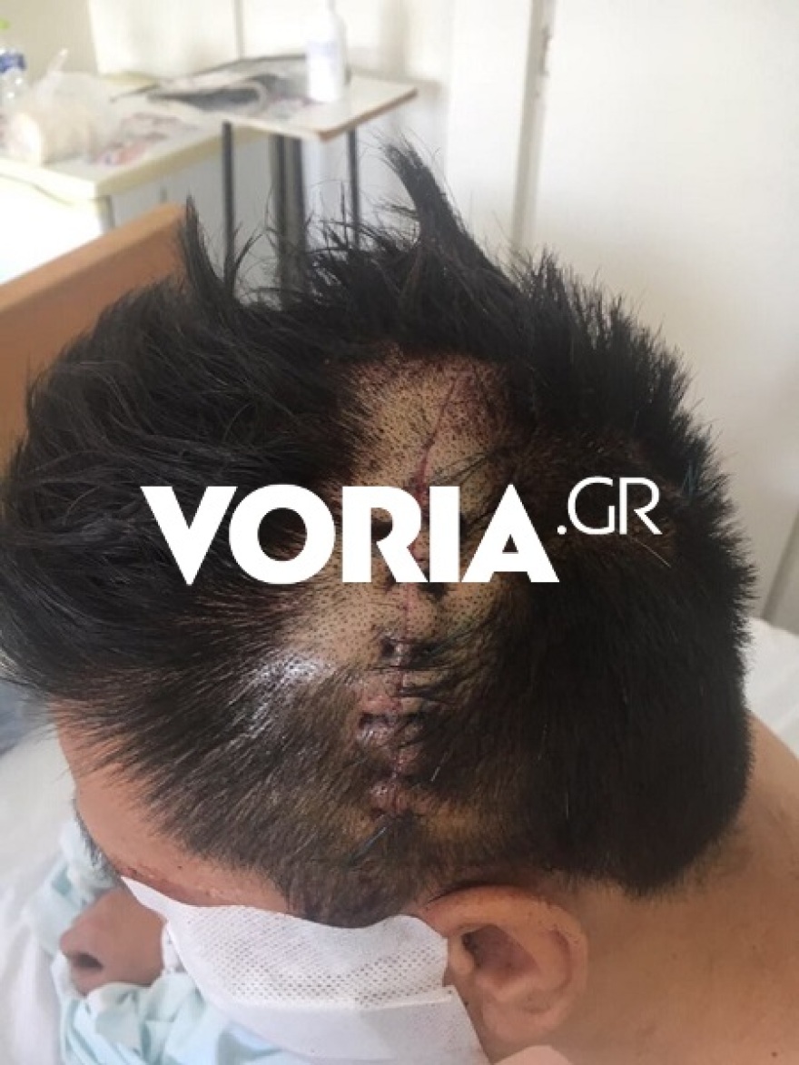 Αιματηρή ενέδρα στη Θεσσαλονίκη - Η στιγμή που Κινέζοι επιχειρηματίες δέχονται άγρια επίθεση