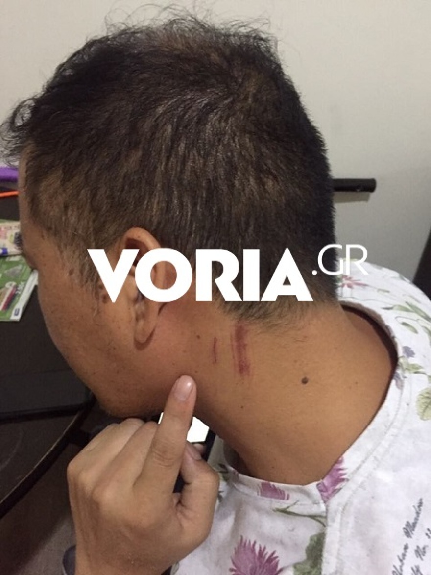 Αιματηρή ενέδρα στη Θεσσαλονίκη - Η στιγμή που Κινέζοι επιχειρηματίες δέχονται άγρια επίθεση