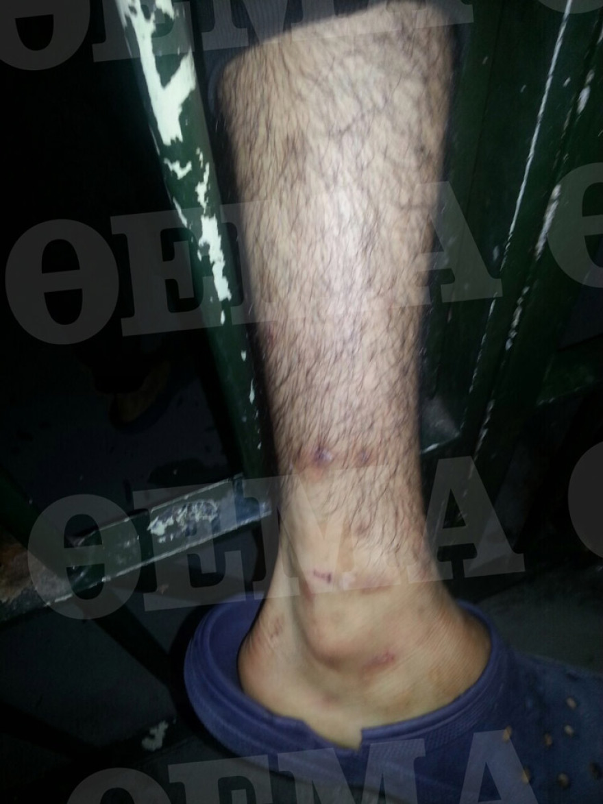 Σοκαριστικές εικόνες από το Αλλοδαπών στην Πέτρου Ράλλη: Κατσαρίδες και σκουπίδια παντού!