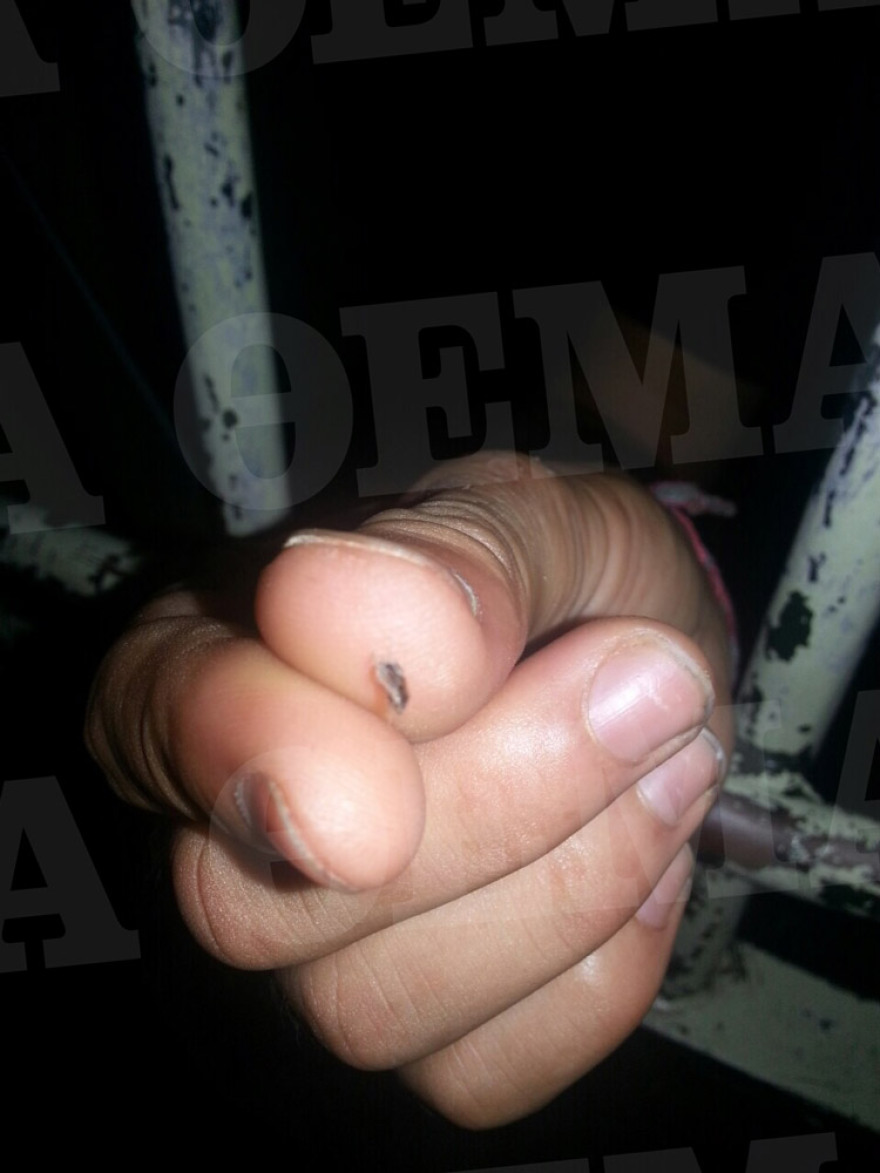 Σοκαριστικές εικόνες από το Αλλοδαπών στην Πέτρου Ράλλη: Κατσαρίδες και σκουπίδια παντού!