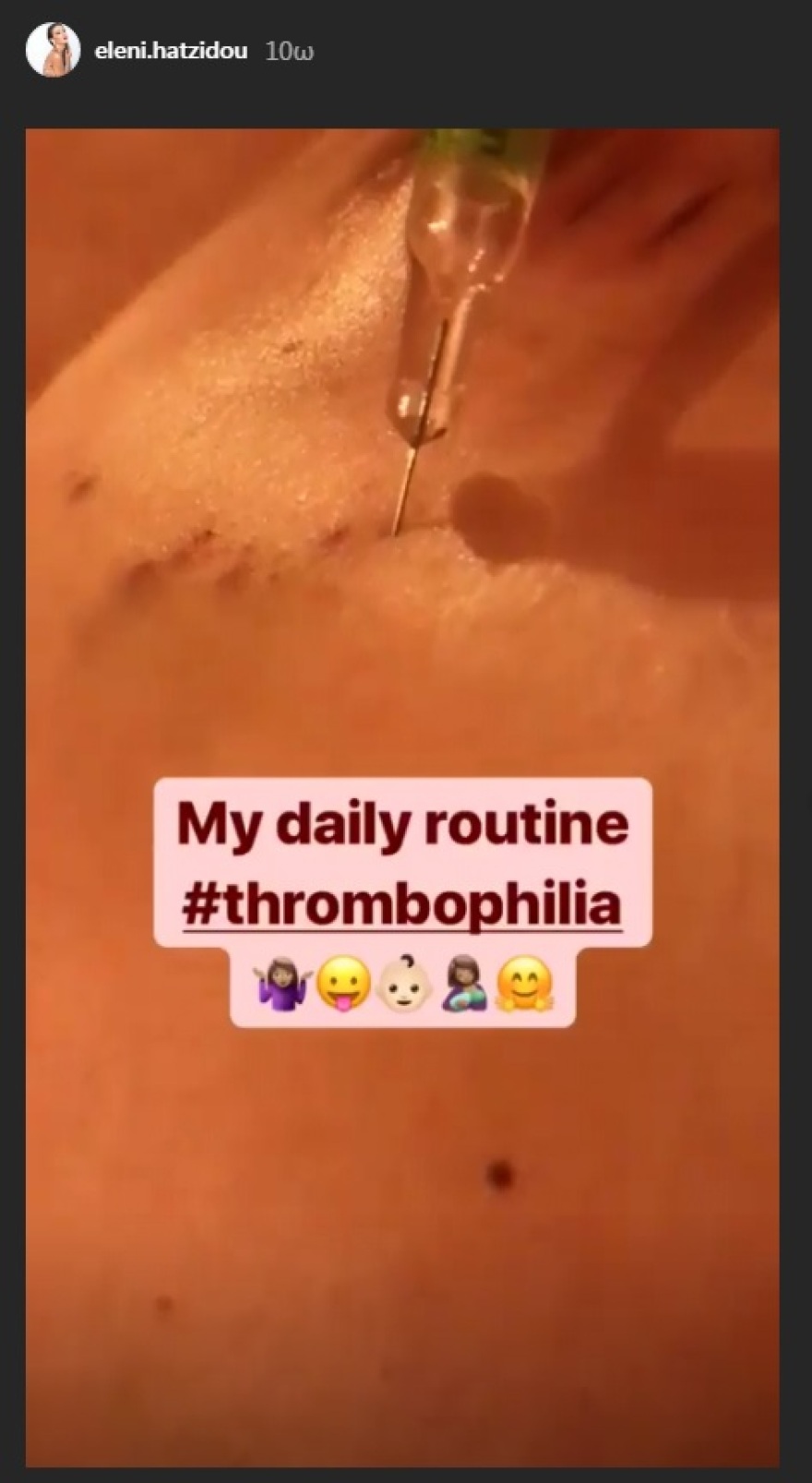 Η έγκυος Ελένη Χατζίδου έβγαλε φωτογραφία την ώρα που κάνει ένεση στην κοιλιά της 