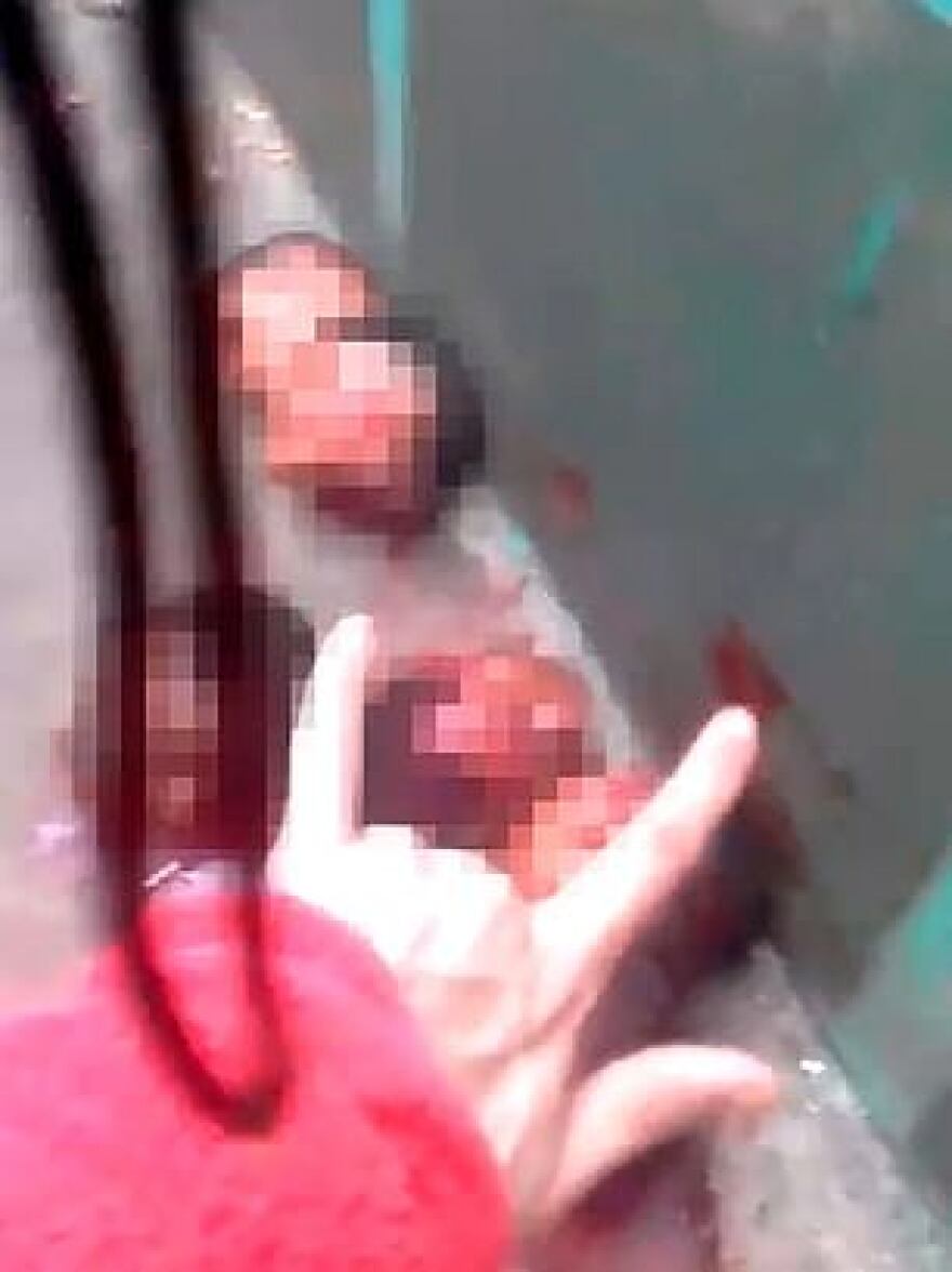 Κτηνωδία στη Βραζιλία: Έπαιζαν ποδόσφαιρο με τα κεφάλια των νεκρών αντιπάλων τους