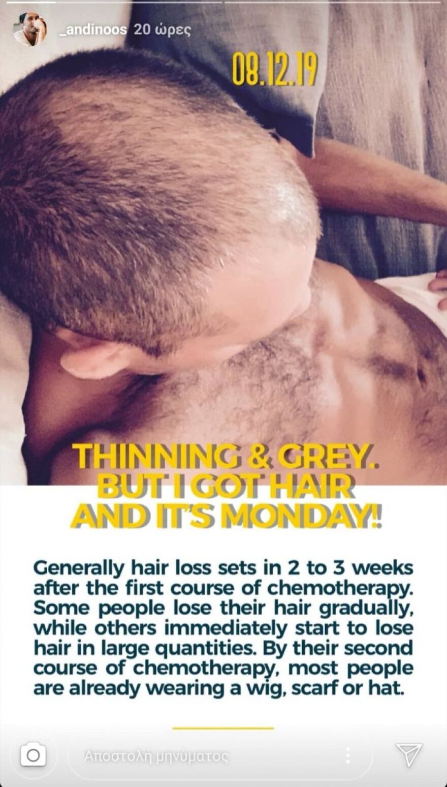 Το μήνυμα του Αντίνοου Αλμπάνη για την υγεία του: «Από τη 2η χημειοθεραπεία οι περισσότεροι φορούν περούκα»