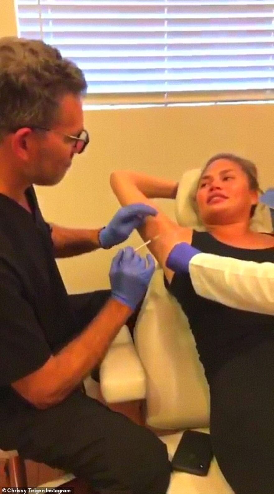 Η Chrissy Teigen έκανε botox στις... μασχάλες