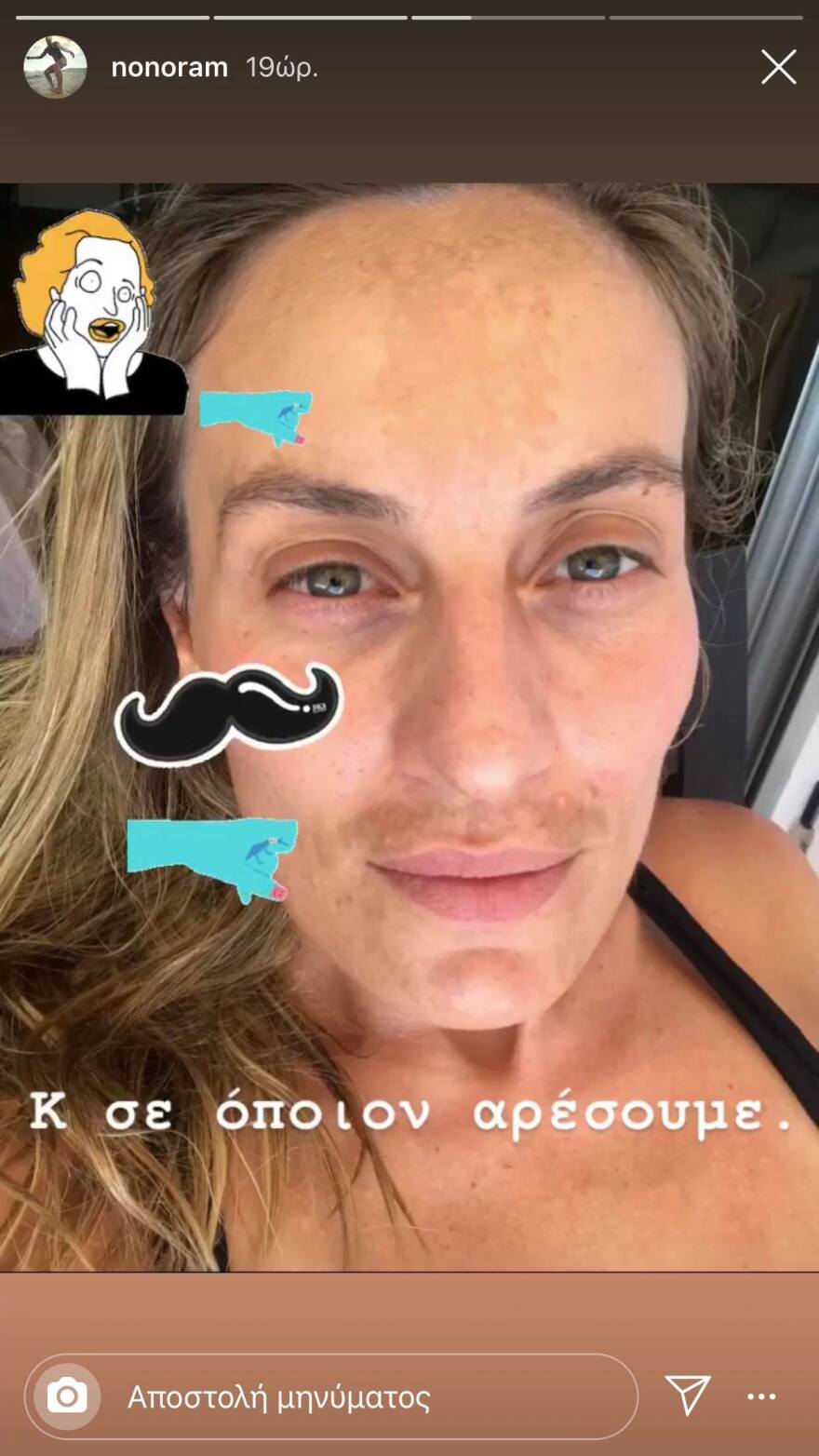 Ελεονώρα Μελέτη: Οι φωτογραφίες με τις πανάδες και το πικρόχολο σχόλιο