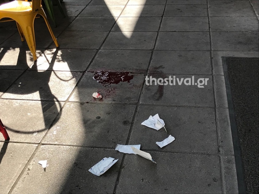 Αιματηρό επεισόδιο στη Θεσσαλονίκη: Πήγε να κλέψει ζευγάρι και τον μαχαίρωσαν στον αυχένα