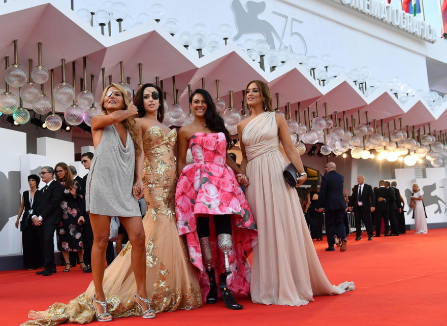 Giusy Versace: Η Παραολυμπιονίκης σπρίντερ που έβαλε μίνι και πήγε στη Μόστρα