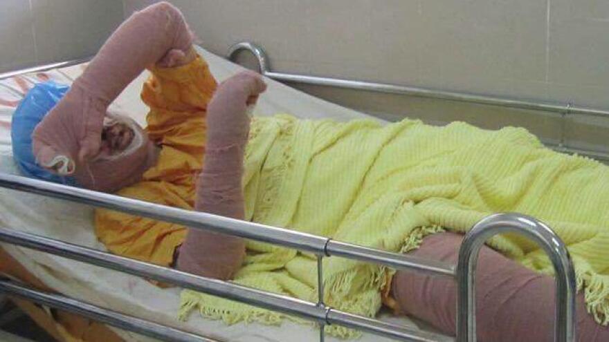 Ιρανή αυτοπυρπολήθηκε επειδή θα τη φυλάκιζαν αφού προσπάθησε να μπει σε γήπεδο ποδοσφαίρου