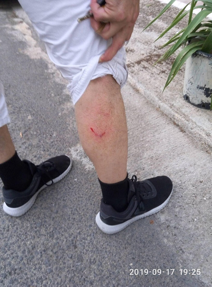 Λαμία: Στο νοσοκομείο 42χρονος μετά από επίθεση αδέσποτων σκύλων