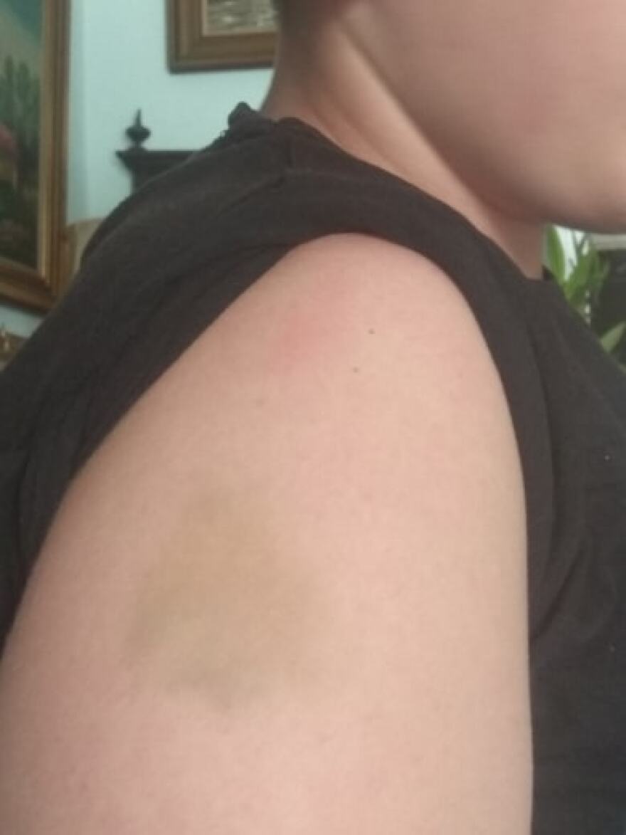 «Έκαναν μπούλινγκ στο παιδί μου κι εκείνο προσπάθησε να αυτοκτονήσει»! 