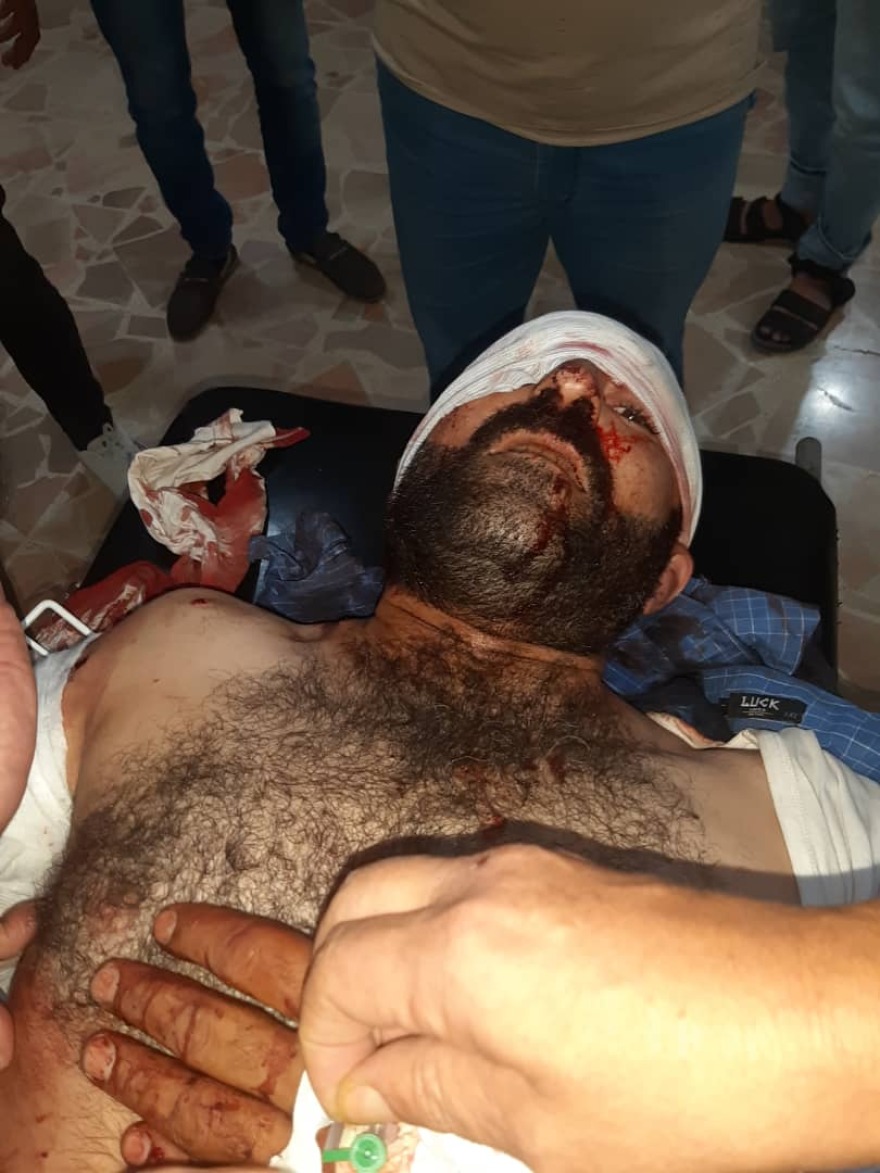 Εικόνες φρίκης από τη Συρία: Ο Ερντογάν χτυπάει Χριστιανούς και Κούρδους