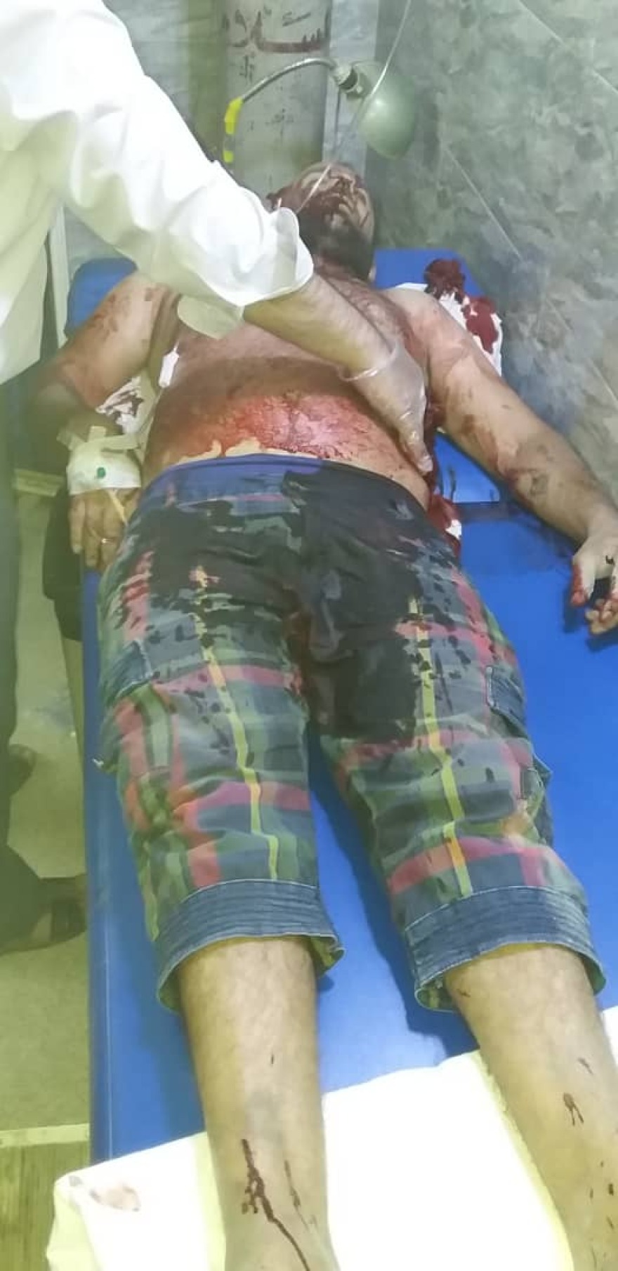 Εικόνες φρίκης από τη Συρία: Ο Ερντογάν χτυπάει Χριστιανούς και Κούρδους