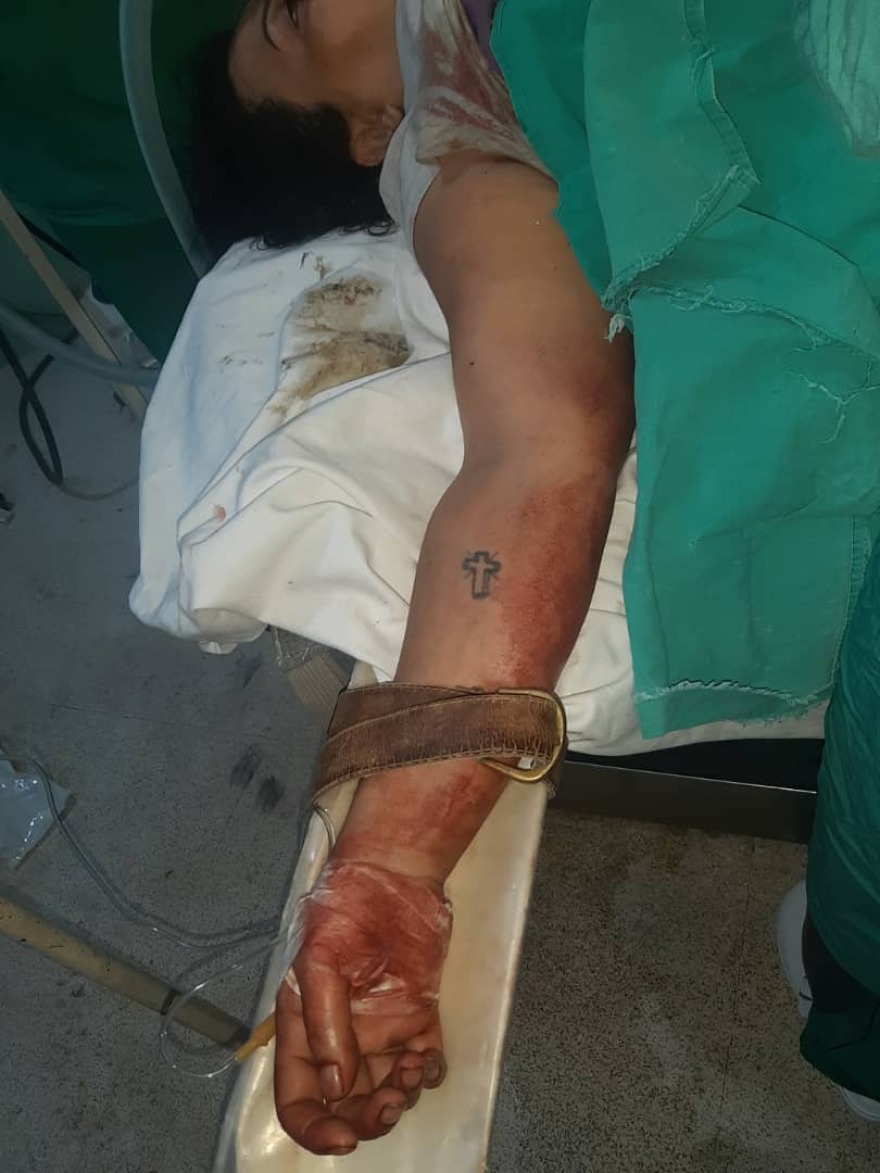 Εικόνες φρίκης από τη Συρία: Ο Ερντογάν χτυπάει Χριστιανούς και Κούρδους