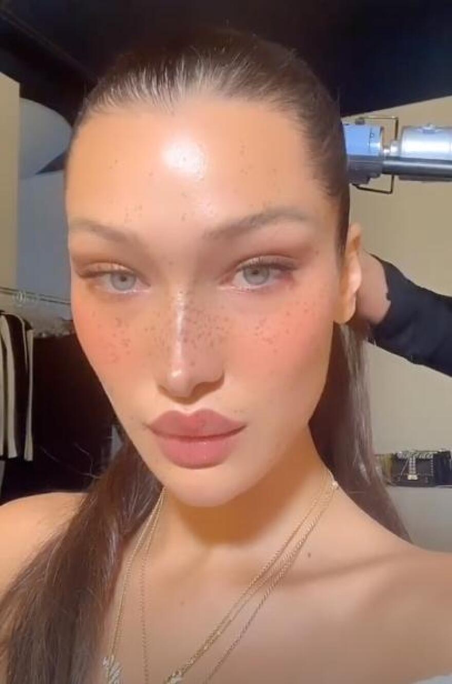 To «ιερό φίλτρο ομορφιάς» των σταρ στο Instagram - Το χρησιμοποιεί και η Κένταλ Τζένερ 