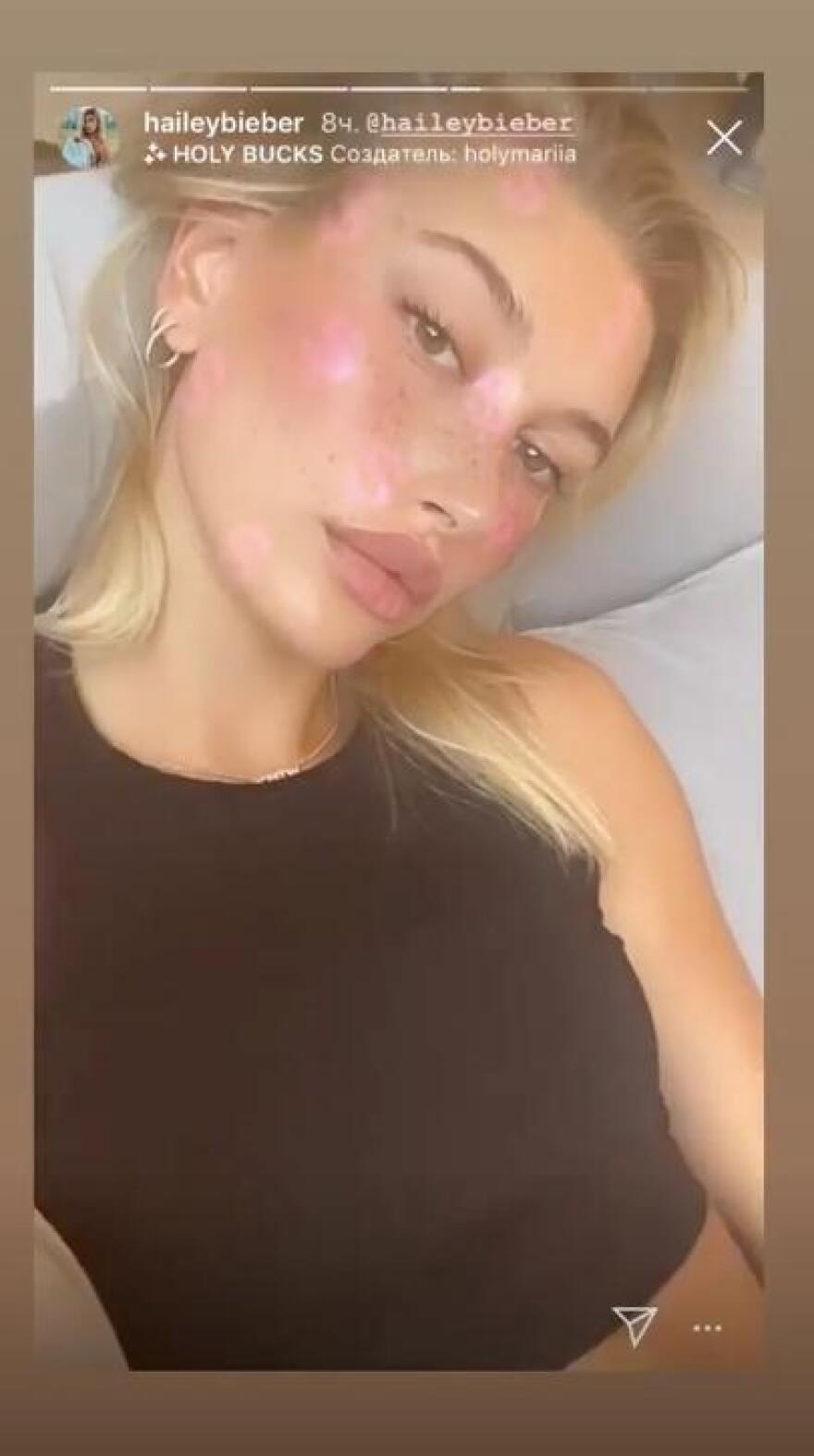 To «ιερό φίλτρο ομορφιάς» των σταρ στο Instagram - Το χρησιμοποιεί και η Κένταλ Τζένερ 