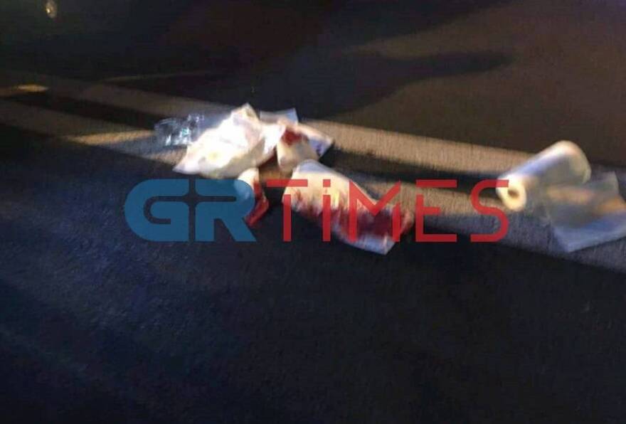 Τροχαίο στη Θεσσαλονίκη: ΙΧ παρέσυρε πεζό - Τραυματίστηκε σοβαρά στο κεφάλι