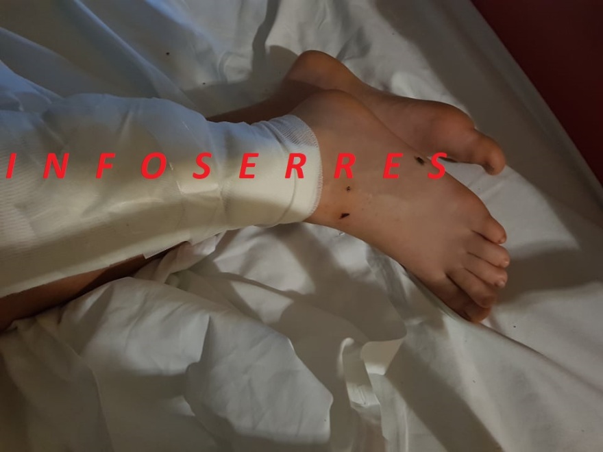 Άγρια επίθεση από σκυλιά σε 9χρονο στις Σέρρες: Δείτε φωτογραφίες με το τραυματισμένο παιδί 