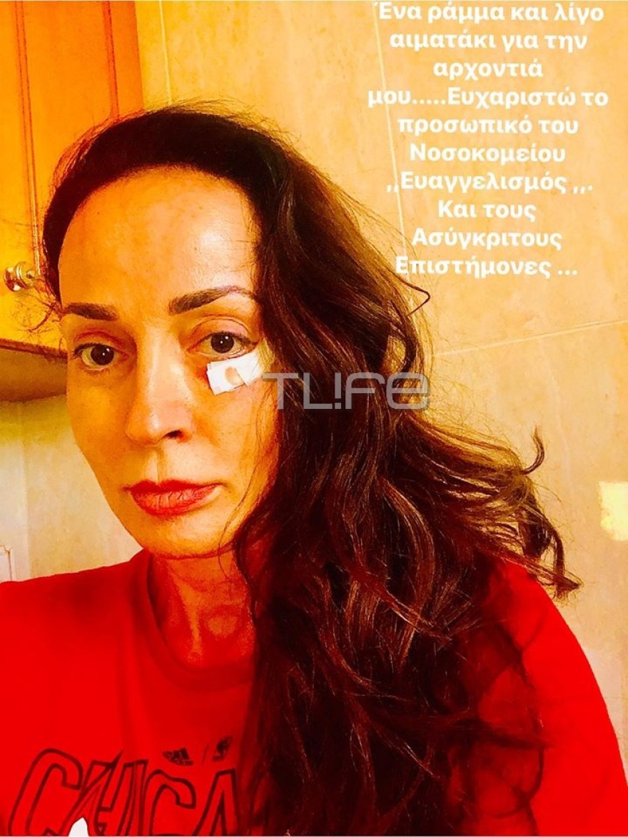 Στο νοσοκομείο η Βίκυ Σταμάτη - Υπεβλήθη σε χειρουργική επέμβαση 