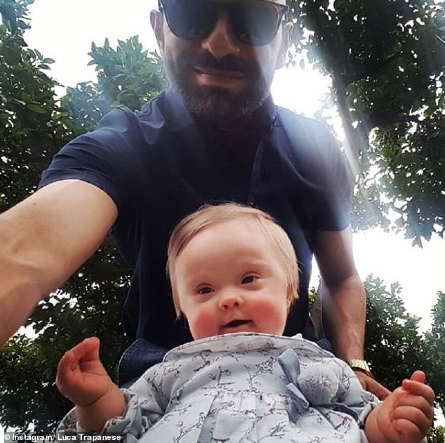 Ιταλία: 41χρονος υιοθέτησε κοριτσάκι με σύνδρομο Down αφού το είχαν απορρίψει 20 οικογένειες