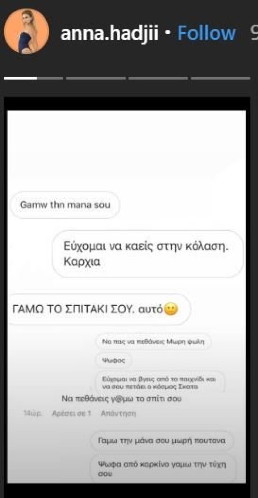 GNTM 2: Η Άννα Χατζή δημοσίευσε τα υβριστικά μηνύματα που δέχεται στα social media