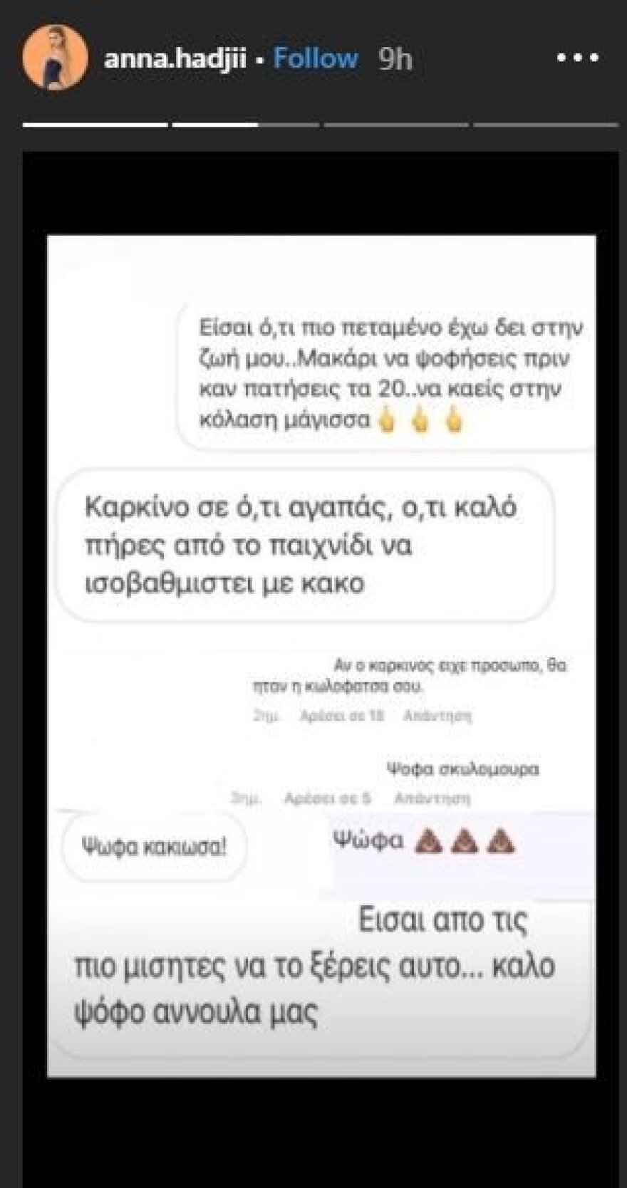 GNTM 2: Η Άννα Χατζή δημοσίευσε τα υβριστικά μηνύματα που δέχεται στα social media