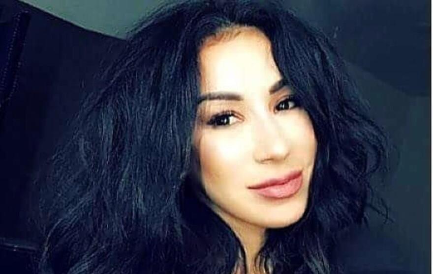 Μοντέλο από το Μεξικό πέθανε μετά από πλαστικές επεμβάσεις