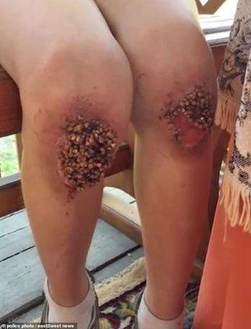 Βαρβαρότητα στη Ρωσία: Γονείς έβαλαν 8χρονο να γονατίσει για 9 ώρες πάνω σε σπόρους