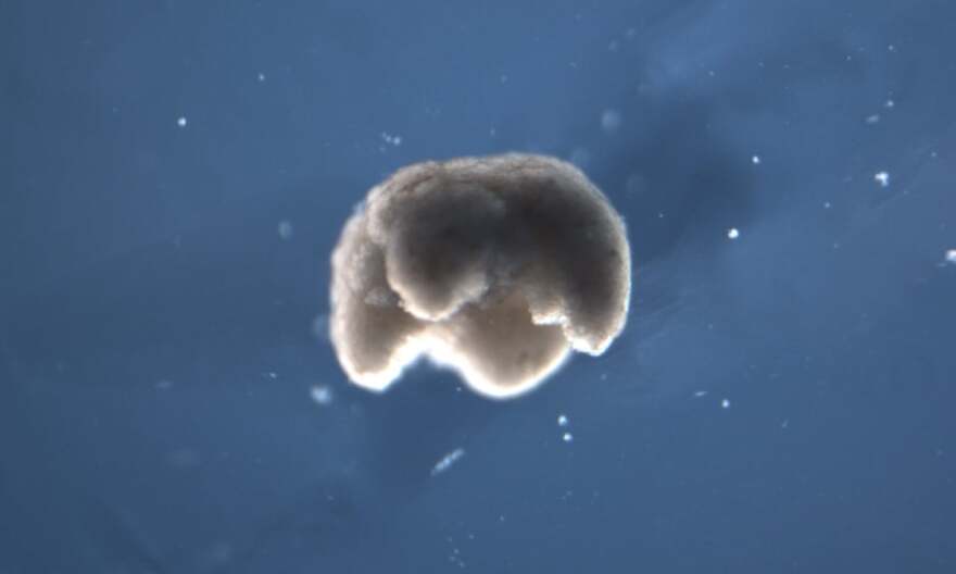 Δημιουργήθηκαν τα πρώτα ζωντανά ρομπότ... και δεν είναι όπως τα φαντάζεστε!