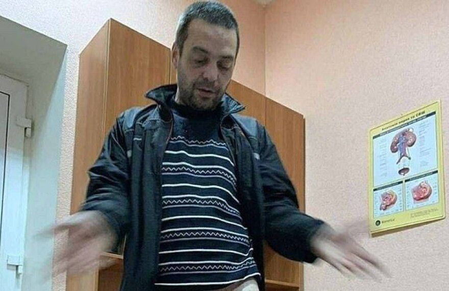 Ουκρανή πέρασε παξιμάδι στο πέος του άπιστου συντρόφου της - Του το έβγαλαν με τροχό