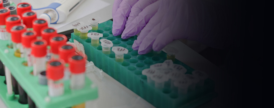 Δίνει ελπίδες το νέο τεστ αίματος για την έγκαιρη διάγνωση πολλών καρκίνων ταυτόχρονα