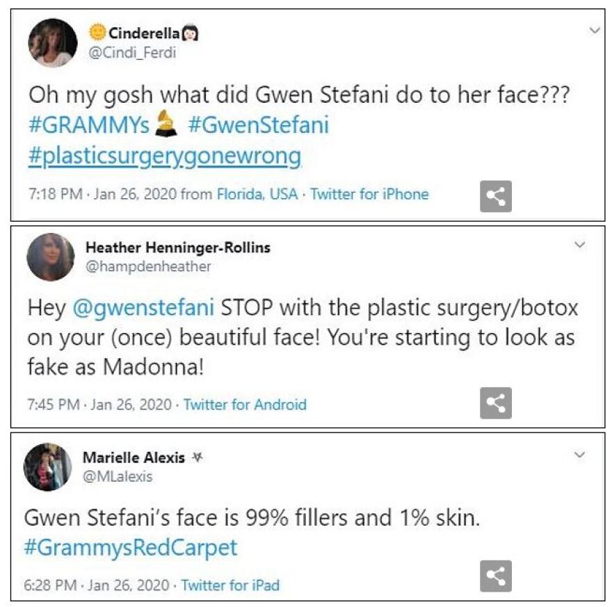 Gwen Stefani: Έχασε την ομορφιά της από τις πλαστικές επεμβάσεις