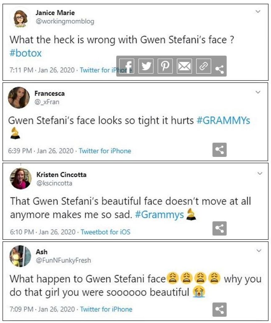 Gwen Stefani: Έχασε την ομορφιά της από τις πλαστικές επεμβάσεις