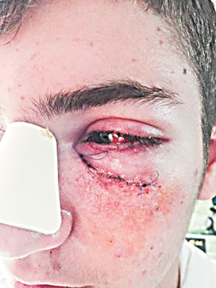 Bullying στα σχολεία: Οι Locos του Βύρωνα και η φωτογραφία σοκ του 17χρονου θύματος