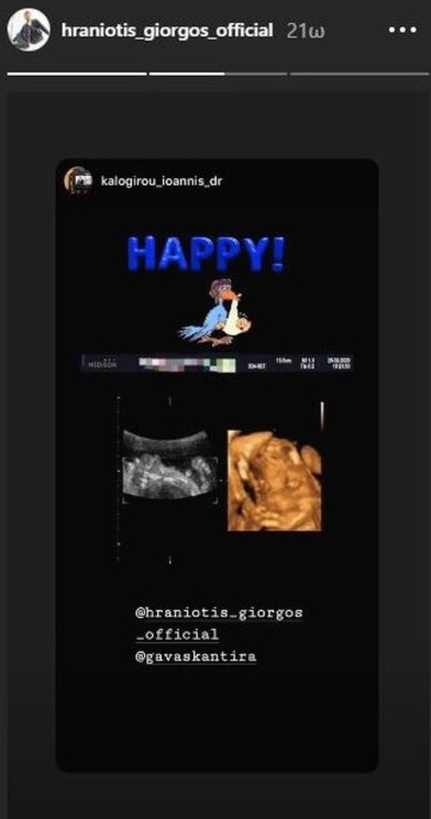 Γιώργος Χρανιώτης: Χαζομπαμπάς από... κούνια