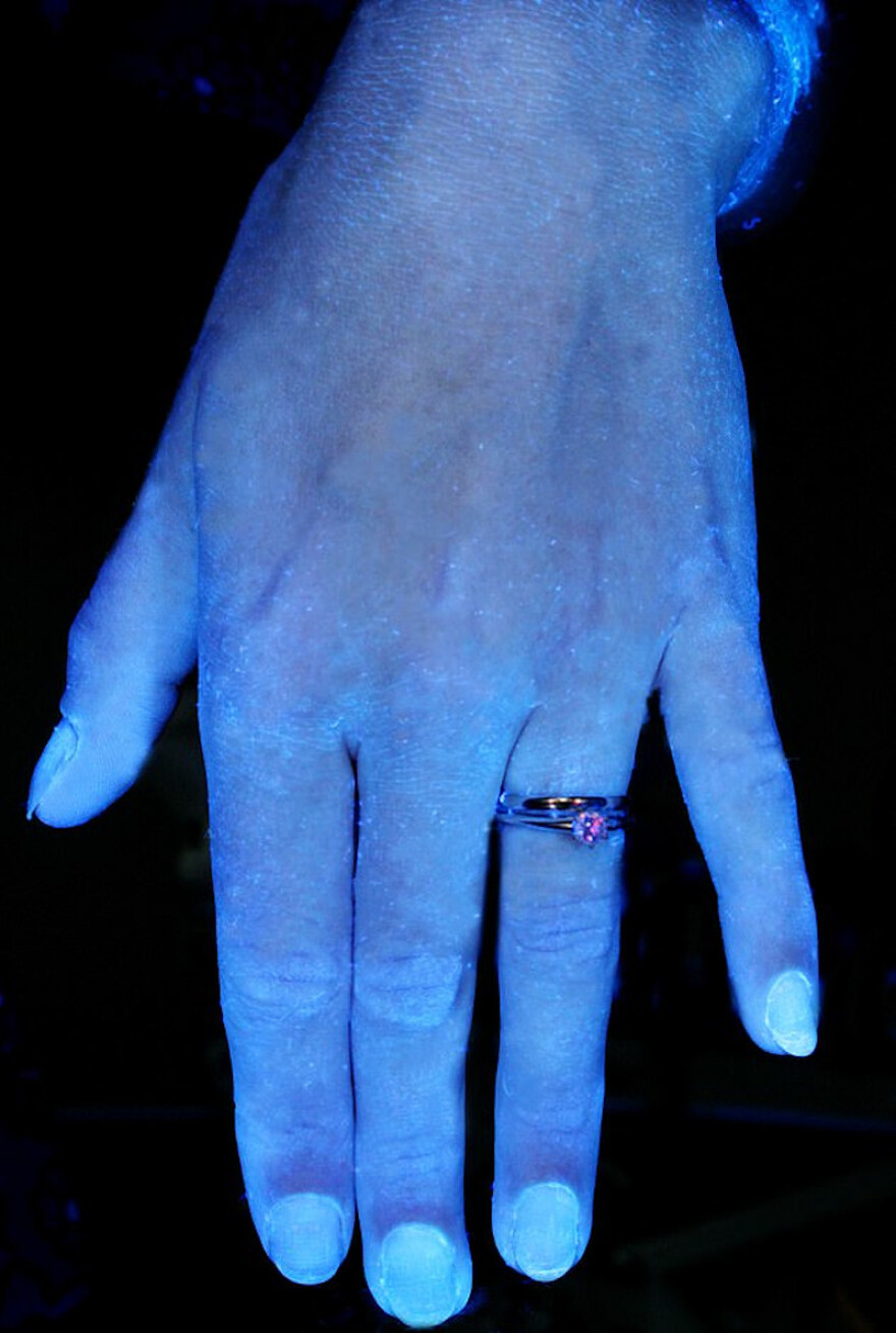 Κορωνοϊός: Υπέρυθρες δείχνουν πώς είναι τα χέρια άπλυτα και πώς πλυμένα - Δείτε φωτογραφίες