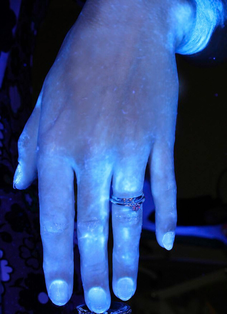 Κορωνοϊός: Υπέρυθρες δείχνουν πώς είναι τα χέρια άπλυτα και πώς πλυμένα - Δείτε φωτογραφίες