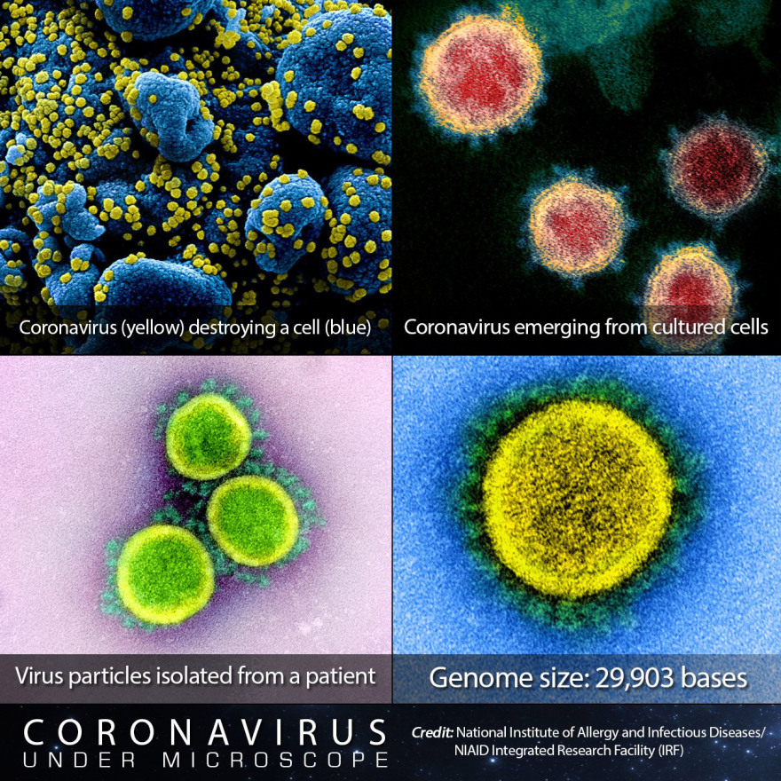 Κορωνοϊός: Επιστήμονες «φωτογράφισαν» τον Covid-19 - Οι πρώτες εικόνες από μικροσκόπιο