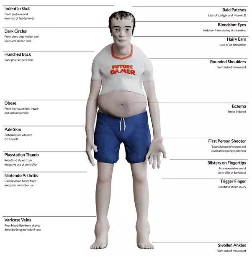 Το τρομακτικό μοντέλο που δείχνει πώς θα μοιάζουν οι gamers σε 20 χρόνια