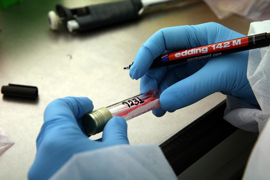 Τεστ κορωνοϊού: Οδηγός 23 ερωταπαντήσεων από το Ινστιτούτο Παστέρ